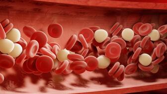 Myelodysplastische Syndrome